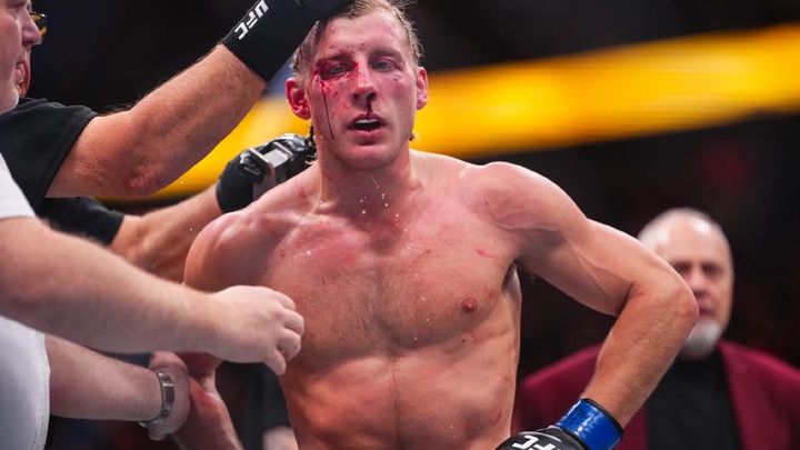 W88 đối tác cá cược chính thức sunderland ⚽ cược thử miễn phí tại 👉 bit.ly/w88fc 🏆 #thethao #u23vietnam #lode #cacuoc #daga #gamedoithuong #quayhu #taixiu #xocdia #sanchoigioitre #cado #gamebai #nohu #banca #afcu23 #tangcode #quayslot #xoso #conggamebai #gamebaidoithuong #gamebaiuytinnhat #thuthuatbanca #rongho #dagathomo #conggamequocte #u23vn #xocdiaonline #vietnam 🔥88 đối tác cá cược chính thức sunderland ⚽ cược thử miễn phí tại 👉 bit.ly/w88fc 🏆 #thethao #u23vietnam #lode #cacuoc #daga #gamedoithuong #quayhu #taixiu #xocdia #sanchoigioitre #cado #gamebai #nohu #banca #afcu23 #tangcode #quayslot #xoso #conggamebai #gamebaidoithuong #gamebaiuytinnhat #thuthuatbanca #rongho #dagathomo #conggamequocte #u23vn #xocdiaonline #vietnam 🔥ị…